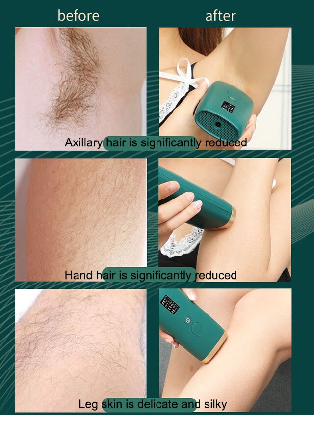 Painless Laser Epilator IPL Hair Removal for Women Photoepilator Home Use Devices Bikini Electric Epilator Wax For Depilation