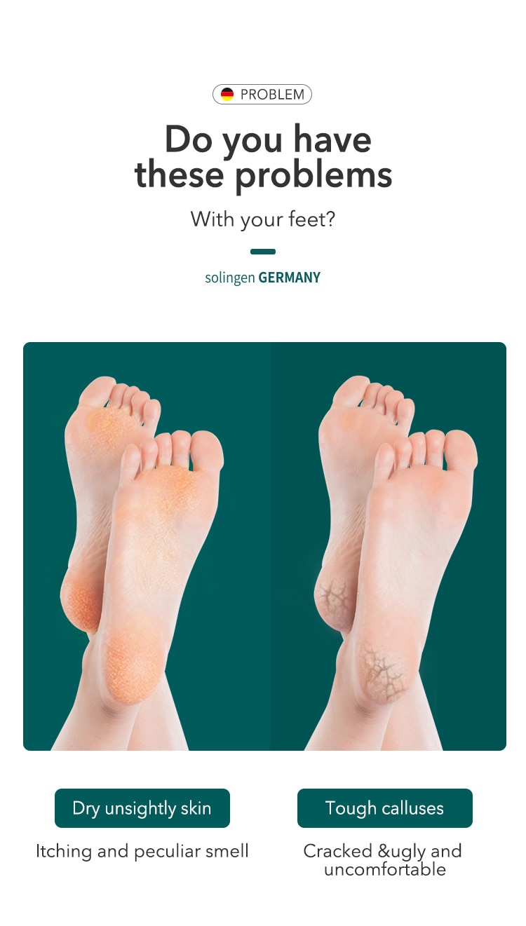 MR.GREEN Pedicure Foot Care Tools Foot File Rasps Callus Dead Foot Skin Care Remover Sets Stainless Steel Professional Two Sides