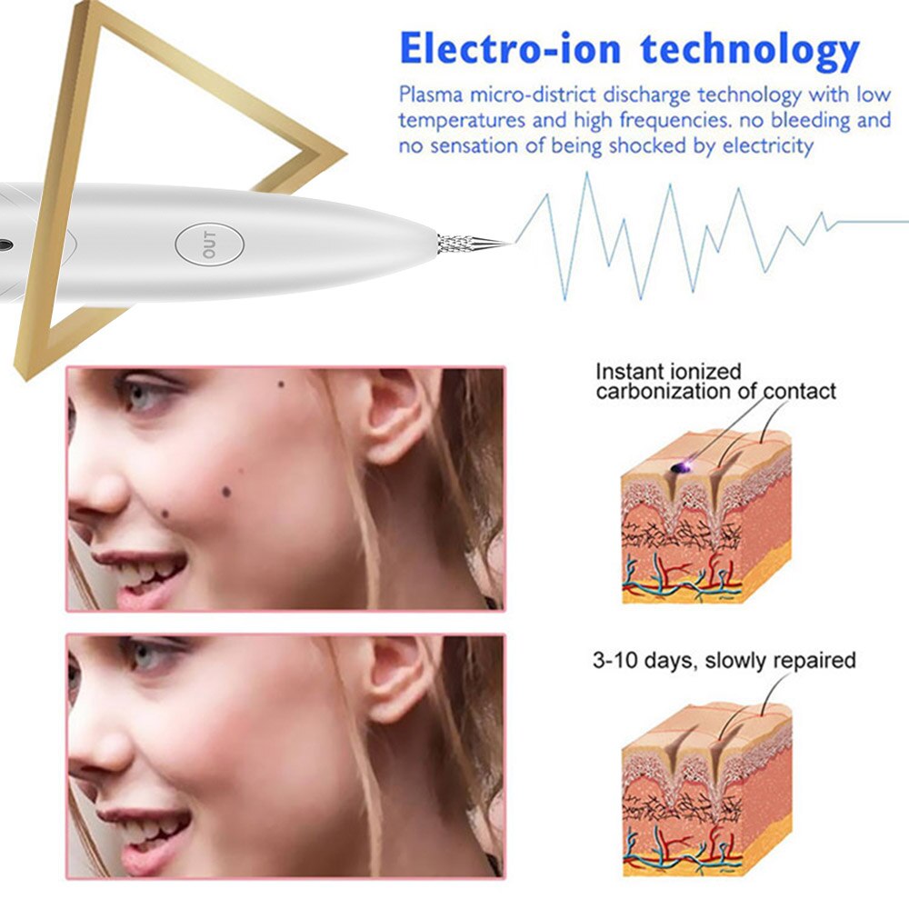 Pen Salon Plasma Pen Black Dots Vacuum Cleaner Laser Freckle Removal Machine Skin Mole Dark Spot Face Wart Tag Tattoo Remover Pen Salon Plasma Pen Black Dots Vacuum Cleaner Laser Freckle Removal Machine Skin Mole Dark Spot Face Wart Tag Tattoo Remover