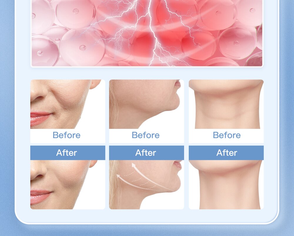 ANLAN Ultrasonic Skin Scrubber Blue Light Skin Care Deep Face Cleaning Peeling Shovel Facial Pore Cleaner Facial Lifting Machine