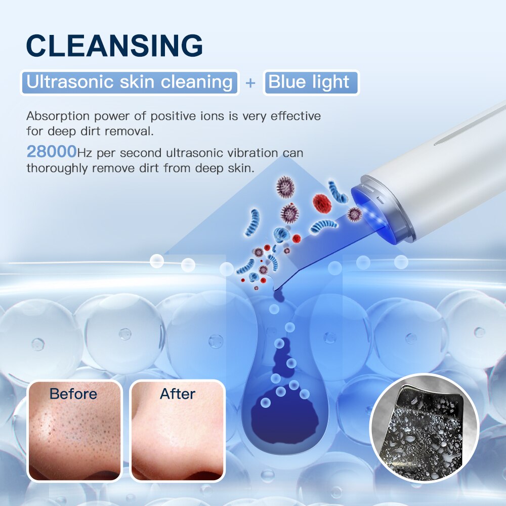 ANLAN Ultrasonic Skin Scrubber Blue Light Skin Care Deep Face Cleaning Peeling Shovel Facial Pore Cleaner Facial Lifting Machine ANLAN Ultrasonic Skin Scrubber Blue Light Skin Care Deep Face Cleaning Peeling Shovel Facial Pore Cleaner Facial Lifting Machine