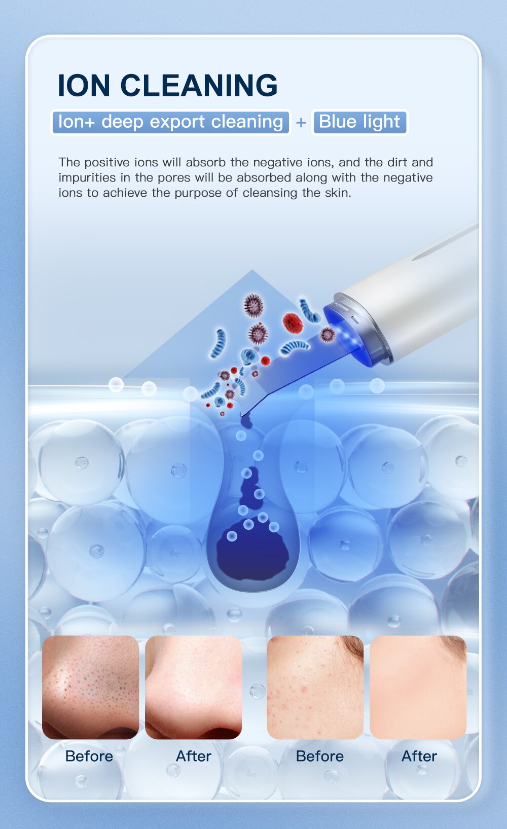 ANLAN Ultrasonic Skin Scrubber Blue Light Skin Care Deep Face Cleaning Peeling Shovel Facial Pore Cleaner Facial Lifting Machine