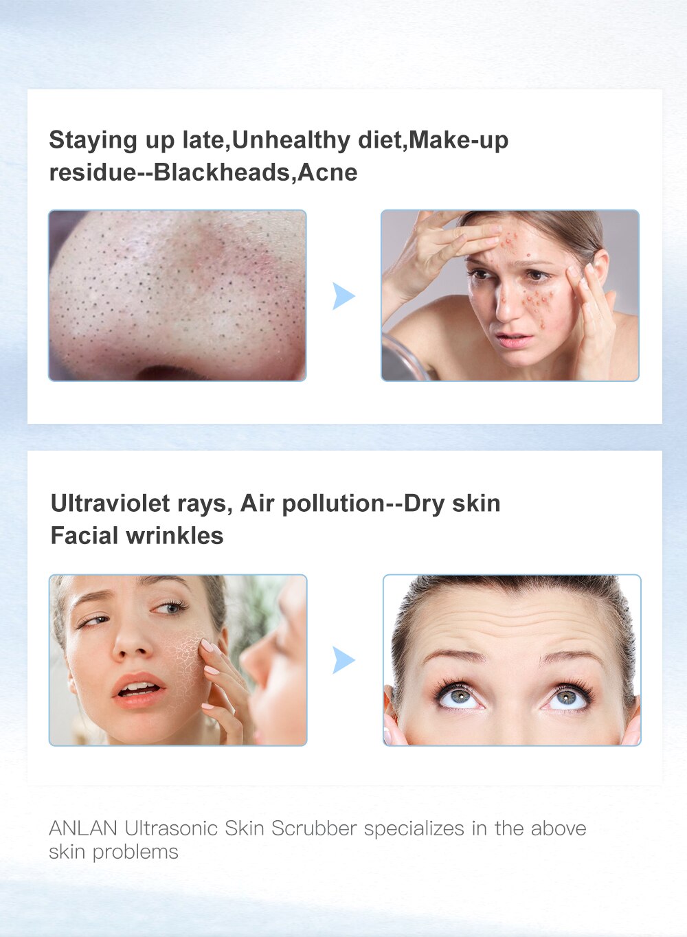 ANLAN Ultrasonic Cleaner 45°C Heat Ultrasonic Skin Scrubber Deep Face Cleaning Machine Shovel Skin Care Face Lift Peeling Facial