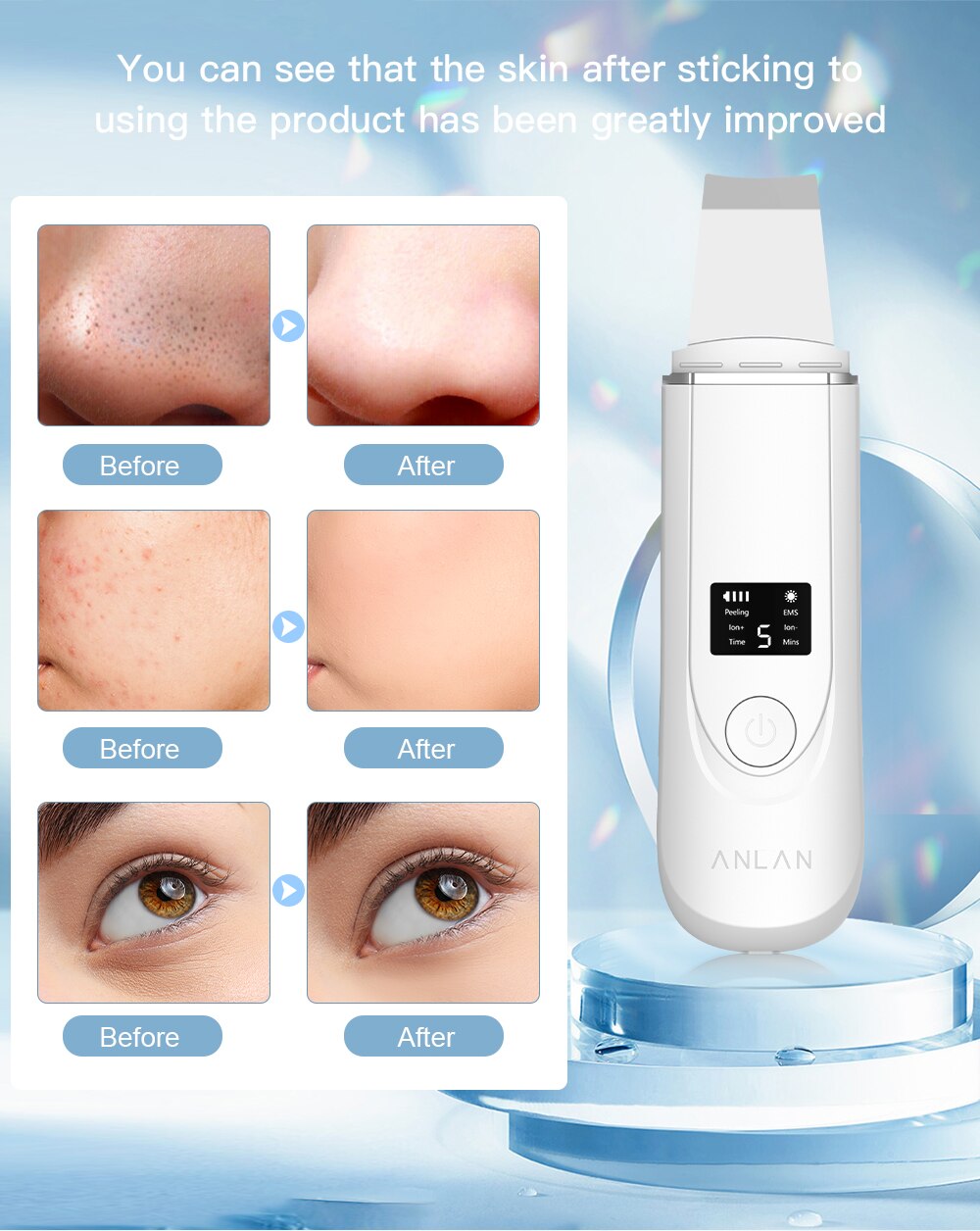 ANLAN Ultrasonic Cleaner 45°C Heat Ultrasonic Skin Scrubber Deep Face Cleaning Machine Shovel Skin Care Face Lift Peeling Facial