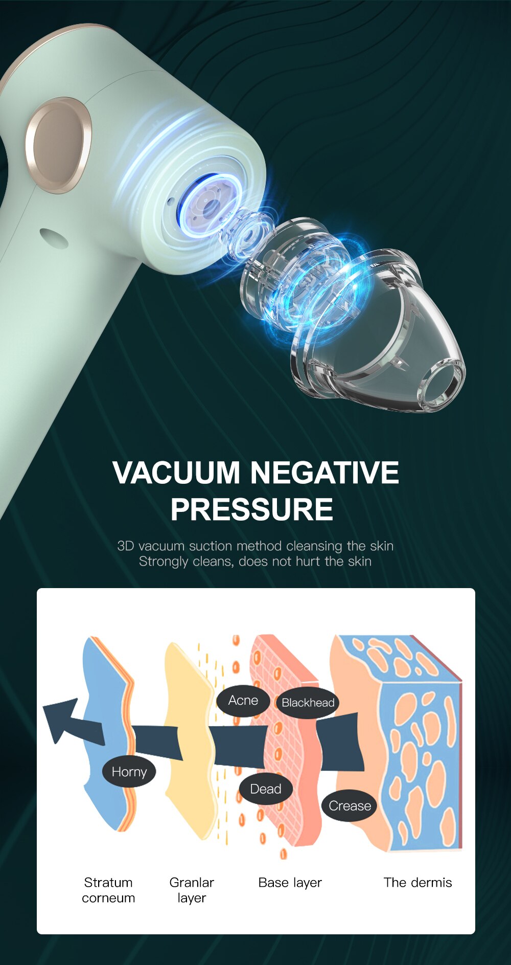 ANLAN Blackhead Remover Vacuum Acne Cleaner Deep Pore Cleaner Light Therapy Skin Care Pimple Remover Tool Facial Cleaning Tools