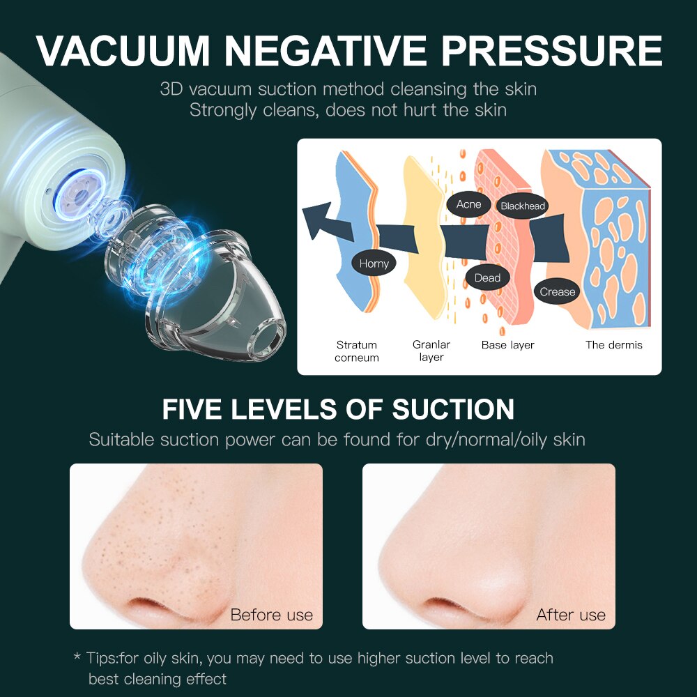 ANLAN Blackhead Remover Vacuum Acne Cleaner Deep Pore Cleaner Light Therapy Skin Care Pimple Remover Tool Facial Cleaning Tools ANLAN Blackhead Remover Vacuum Acne Cleaner Deep Pore Cleaner Light Therapy Skin Care Pimple Remover Tool Facial Cleaning Tools