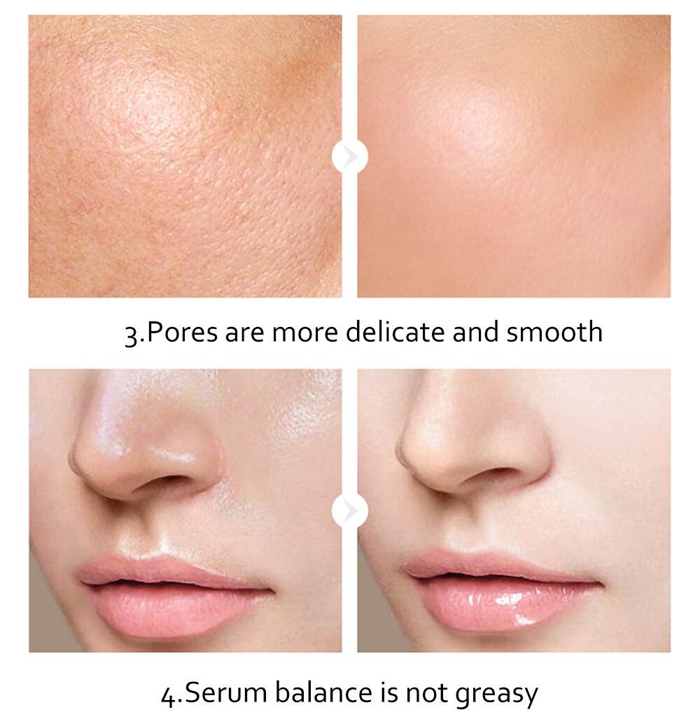 Skincare Product 24K Gold Niacinamide Face Serum Anti Aging Hyaluronic Acid for Face Shrinks Pores Korean Skin Care Products