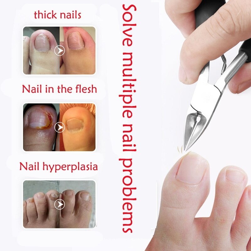 Toe Nail Clippers Nail Correction Thick Nails Ingrown Toenails Nippers Cutters Dead Skin Dirt Remover Pedicure Care Tool 2021