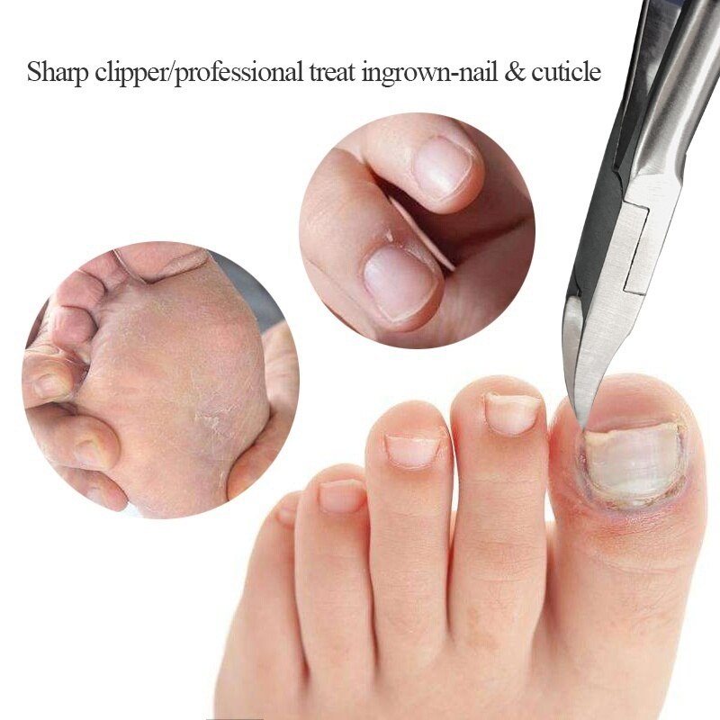 Toe Nail Clippers Nail Correction Thick Nails Ingrown Toenails Nippers Cutters Dead Skin Dirt Remover Pedicure Care Tool 2021