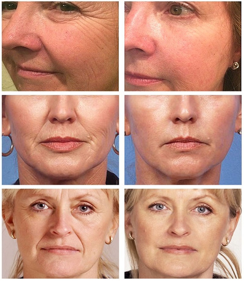Instant Wrinkle Remover Face Serum Lift Firm Anti-aging Fade Fine Lines Moisturizing Essence Whitening Brighten Repair Skin Care Instant Wrinkle Remover Face Serum Lift Firm Anti-aging Fade Fine Lines Moisturizing Essence Whitening Brighten Repair Skin Care