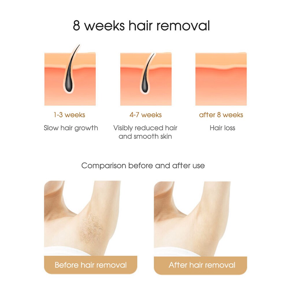 [ZS] Body Bikini IPL 500,000 Flash Depilator Pulses Permanent Laser Epilator Painless For Women Hair Removal Home Use Devices