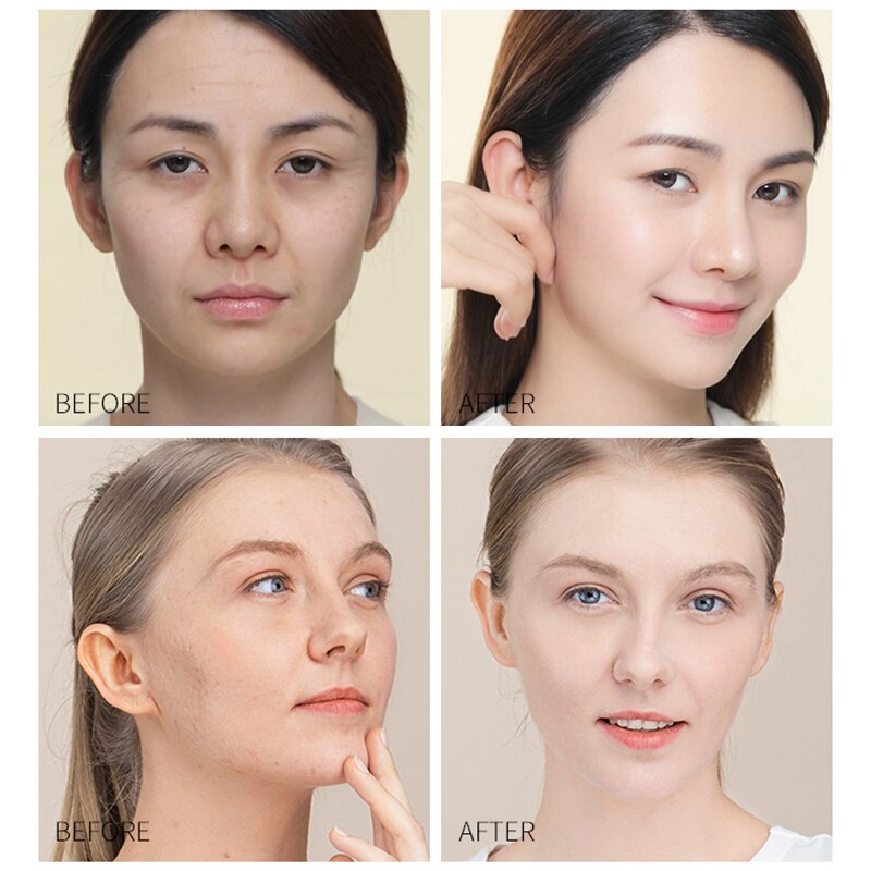 24K Gold Niacinamide Face Essence Deeply Nourishes Anti Wrinkles Vitamin C Serum Retinol Serum Fade Dark Spots Skin Care Product 24K Gold Niacinamide Face Essence Deeply Nourishes Anti Wrinkles Vitamin C Serum Retinol Serum Fade Dark Spots Skin Care Product