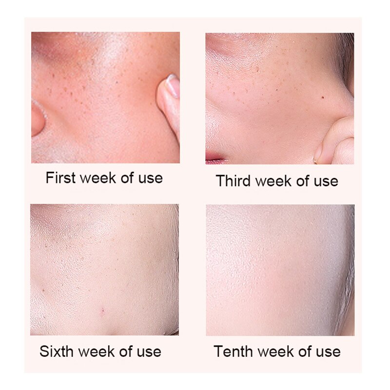 Blood Orange Tender Moisturizing Essence Nourishing Hyaluronic Acid Face Serum Brighten Skin Nicotinamide Face Solution Blood Orange Tender Moisturizing Essence Nourishing Hyaluronic Acid Face Serum Brighten Skin Nicotinamide Face Solution