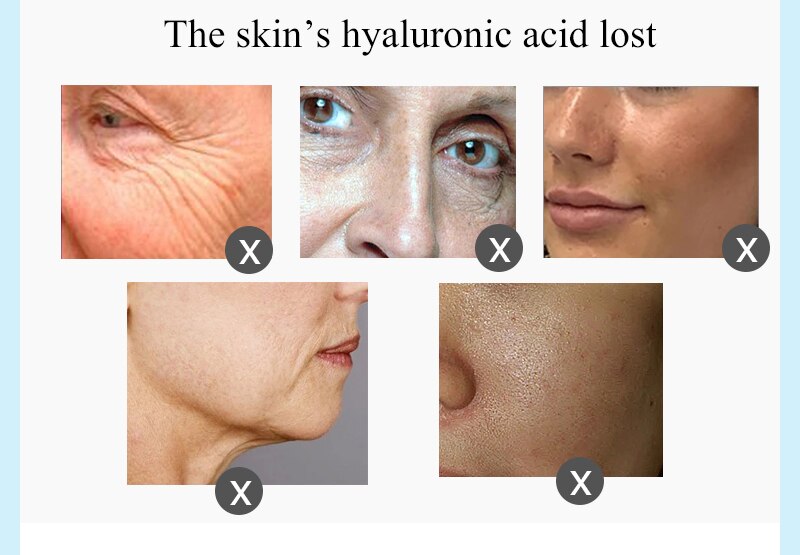100ML Hyaluronic Acid Serum Facial Acido Hialuronico Bioaqua Essence Hyaluronik Asit Skin Face Serum Beauty Moisturizer