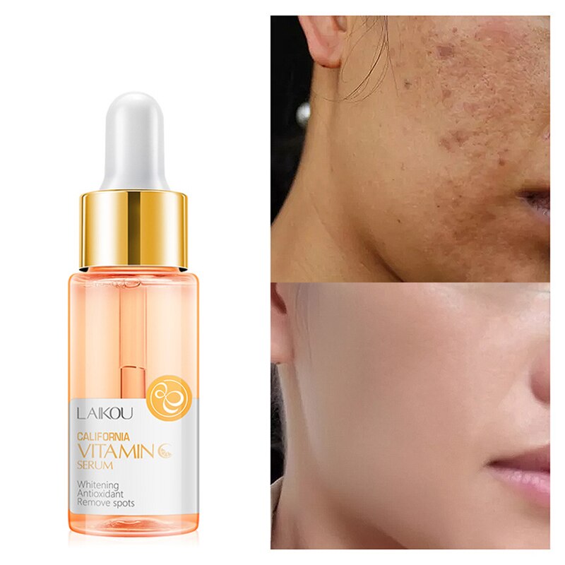 Face Serum skin whitening essence Vitamin C&E Anti-Aging Acne Shrink pores Hydration skin care