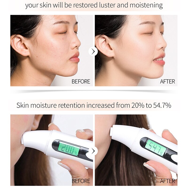 Face Serum skin whitening essence Vitamin C&E Anti-Aging Acne Shrink pores Hydration skin care Face Serum skin whitening essence Vitamin C&E Anti-Aging Acne Shrink pores Hydration skin care