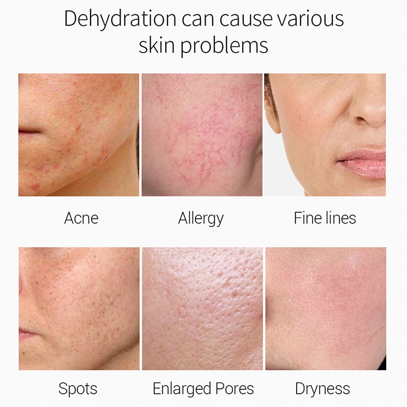 Deep Sea Caviar Face Essence Quickly Absorb Deeply Hydrates Repair Skin Barrier Anti Aging Brighten Firm Skin Care Stock Liquid Deep Sea Caviar Face Essence Quickly Absorb Deeply Hydrates Repair Skin Barrier Anti Aging Brighten Firm Skin Care Stock Liquid