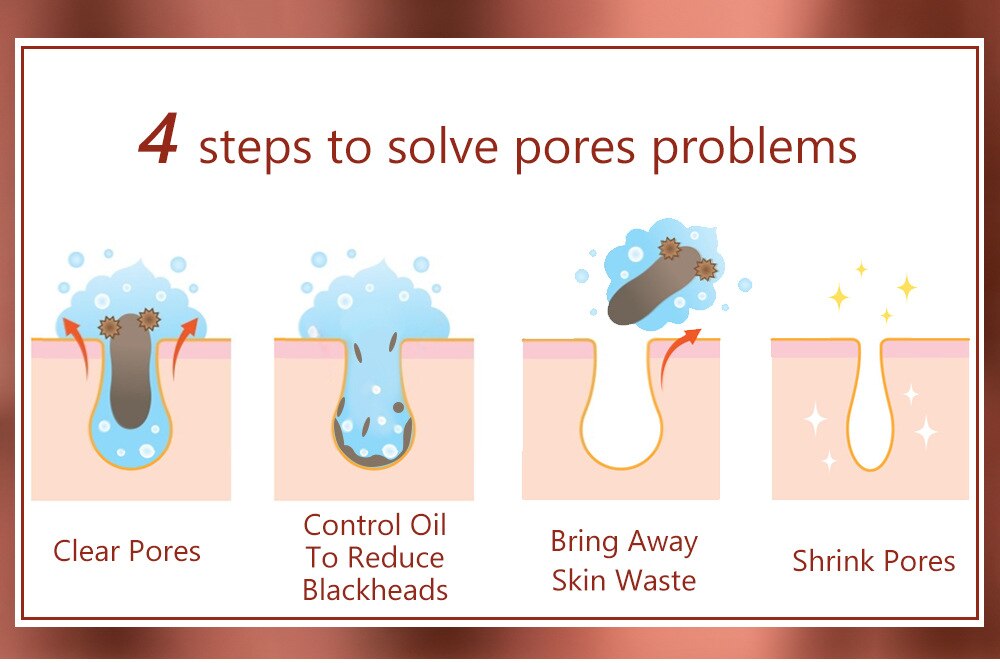 Salicylic Acid Facial Serum Improve Oily Skin Clean Pores Remove Blackhead Face Essence Relieves Redness Acne Treatment Solution