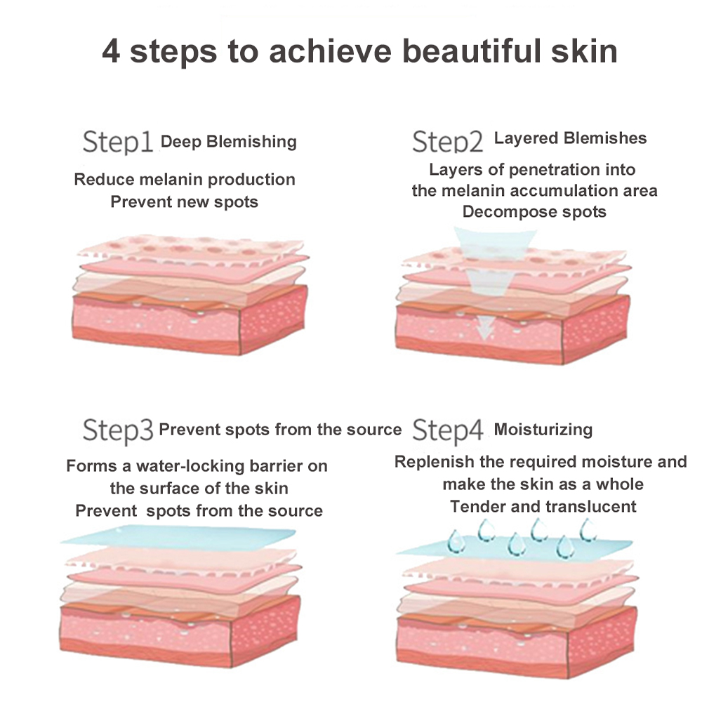 100ml Whiten Freckle Essence Remove Melasma Cream Remove Dark Spots Melanin Melasma Remover Brighten Skin Anti Aging Skin Care