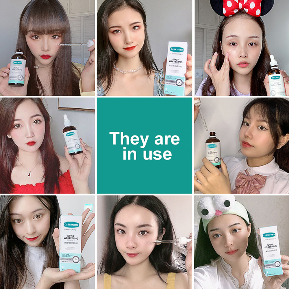 100ml Whiten Freckle Essence Remove Melasma Cream Remove Dark Spots Melanin Melasma Remover Brighten Skin Anti Aging Skin Care