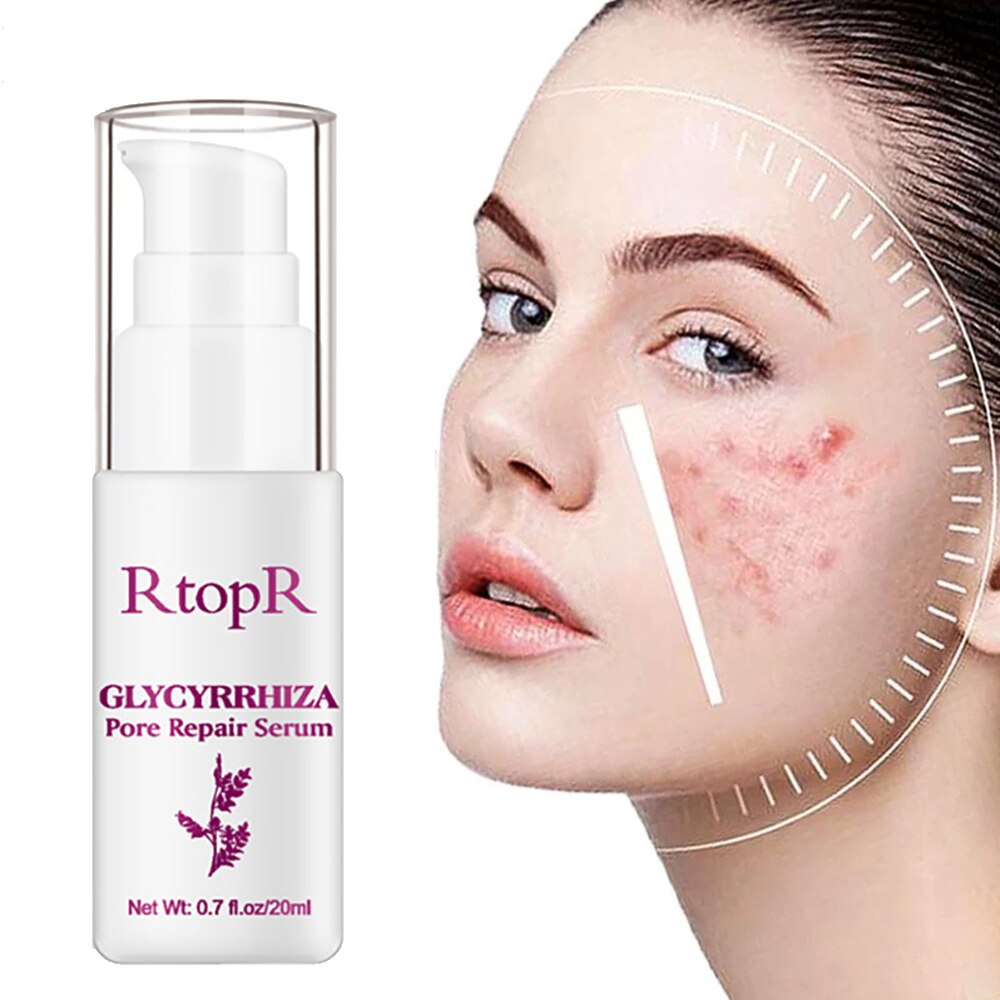 Natural Licorice Facial Pore Repair Essence Anti Inflammatory Refine Pores Improve Rough Dull Smooth Brighten Skin Care Serum Natural Licorice Facial Pore Repair Essence Anti Inflammatory Refine Pores Improve Rough Dull Smooth Brighten Skin Care Serum