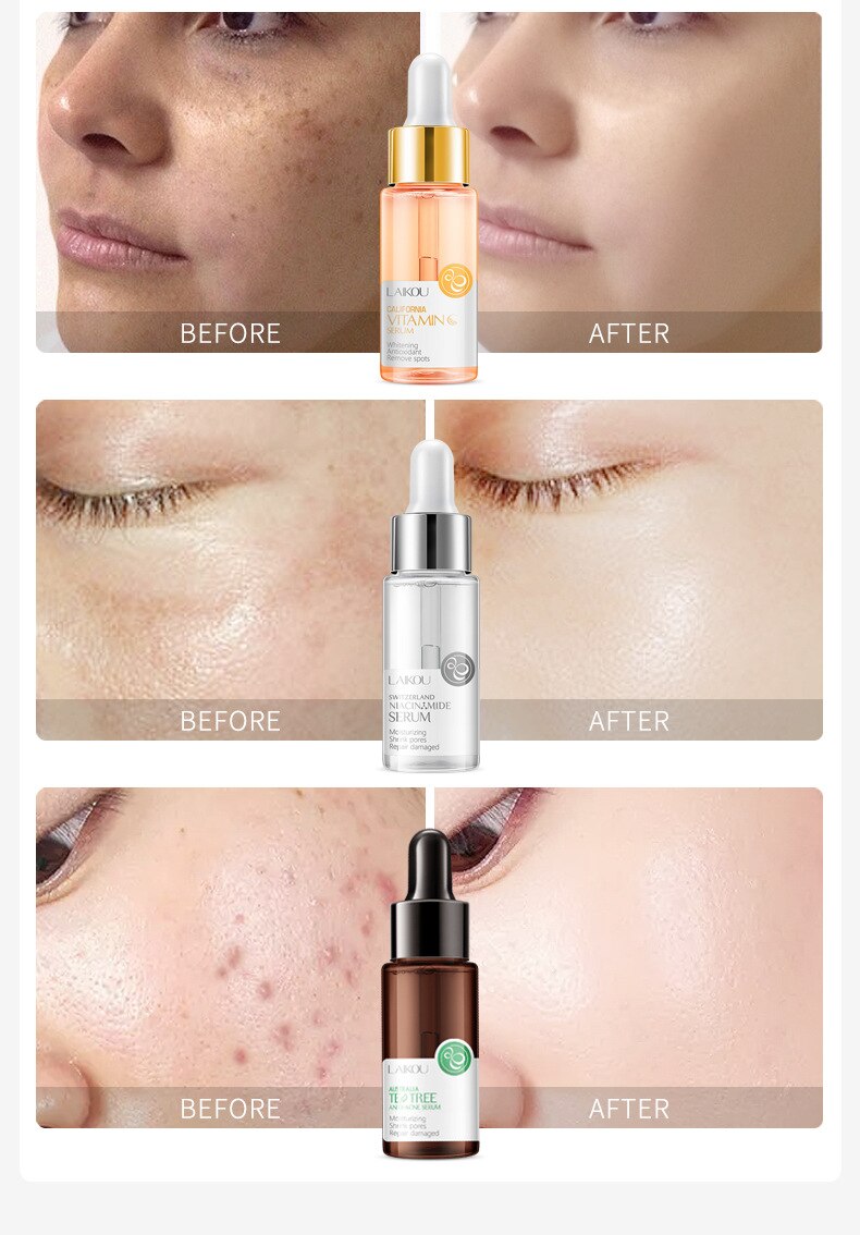 Skin Care Set Hyaluronic Acid Vitamin C 24K Gold Snail Moisturizing Essence Whitening Face Serum Korean Skin Care Products 17ML