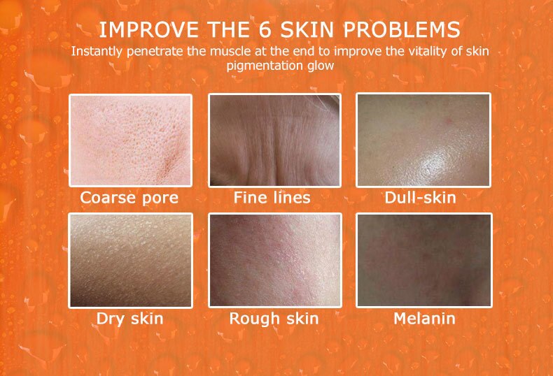 ARTISCARE Serum for Face Whitening Anti Wrinkles 8PCS Hyaluron Acid Anti Aging Vitamain C Essence Acne Skin Care Facial Product