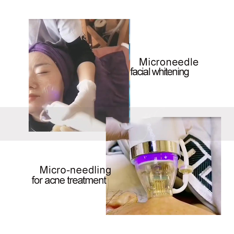 Fractional Rf Microneedle Radio Frequency Microneedling Machine Facial Thermage Skin Tightening Lifting Care Device For Face Fractional Rf Microneedle Radio Frequency Microneedling Machine Facial Thermage Skin Tightening Lifting Care Device For Face