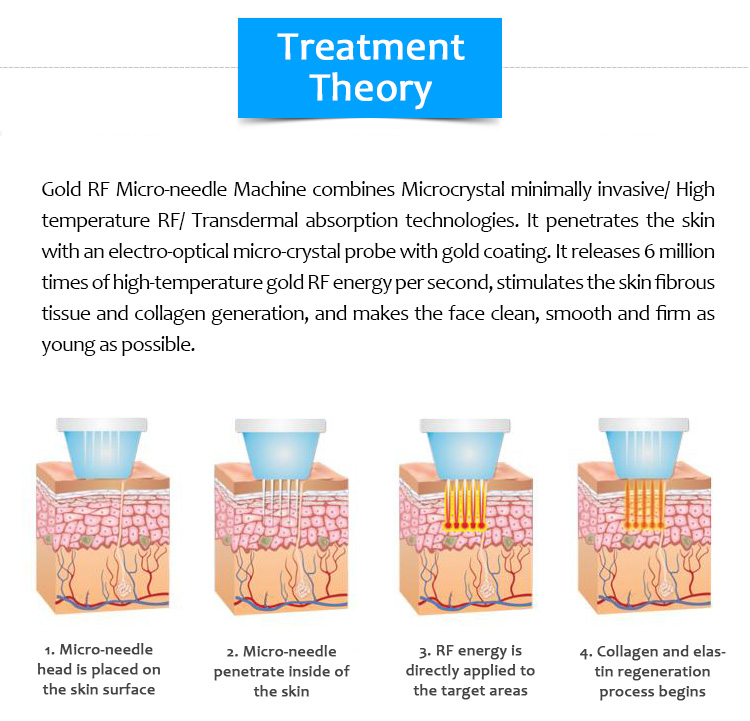 3 In 1 Rf Microneedling Machine Nano Radiofrequency Fractional Skin Tightening Microneedle 2 In 1 Gold Professional Machine Ems 3 In 1 Rf Microneedling Machine Nano Radiofrequency Fractional Skin Tightening Microneedle 2 In 1 Gold Professional Machine Ems