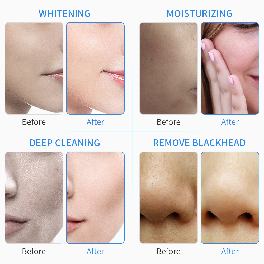 Water Dermabrasion Machine Hydrogen Oxygen Facial Bubble Machine with Hydra Facial Skin Care Serum Facial Aqua Peel Solution