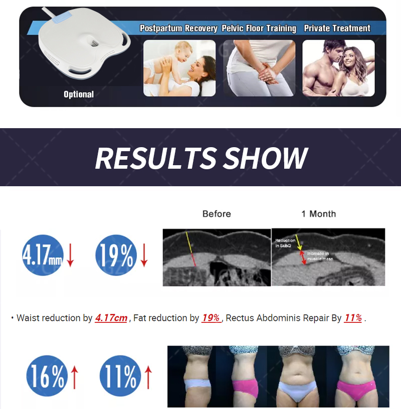 2023 popular EMSzero Neo 14Tesla 6000W Nova EMS HI-EMT Body Sculpt Muscle Machine Weight Electromagnetic slimming Dls-Emslim