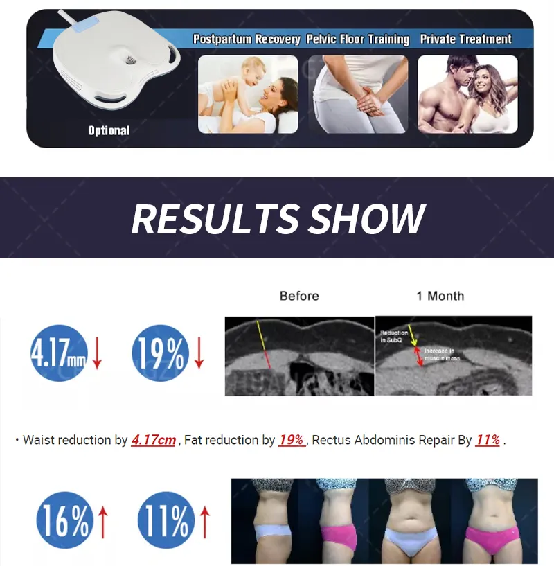 DLS-EMSlim Neo RF machine 14 Tesla 6500W Electromagnetic Body Slim Muscle Stimulate EMSzero Build Muscle Sculpting Machine DLS-EMSlim Neo RF machine 14 Tesla 6500W Electromagnetic Body Slim Muscle Stimulate EMSzero Build Muscle Sculpting Machine