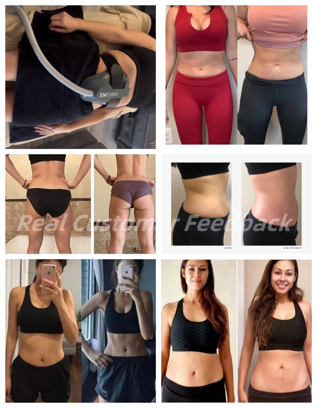 DLS-EMSlim Neo RF machine 14 Tesla 6500W Electromagnetic Body Slim Muscle Stimulate EMSzero Build Muscle Sculpting Machine DLS-EMSlim Neo RF machine 14 Tesla 6500W Electromagnetic Body Slim Muscle Stimulate EMSzero Build Muscle Sculpting Machine