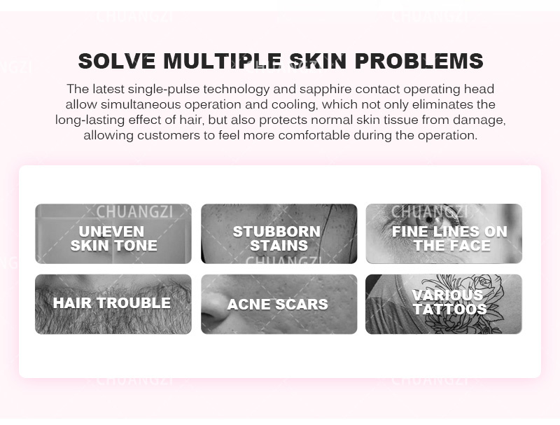 Hot Sell Multifunction 3 in 1 Tattoo Removal Machine Permanent IPL RF Nd Yag Laser Hair Removal Beauty Equipment Hot Sell Multifunction 3 in 1 Tattoo Removal Machine Permanent IPL RF Nd Yag Laser Hair Removal Beauty Equipment