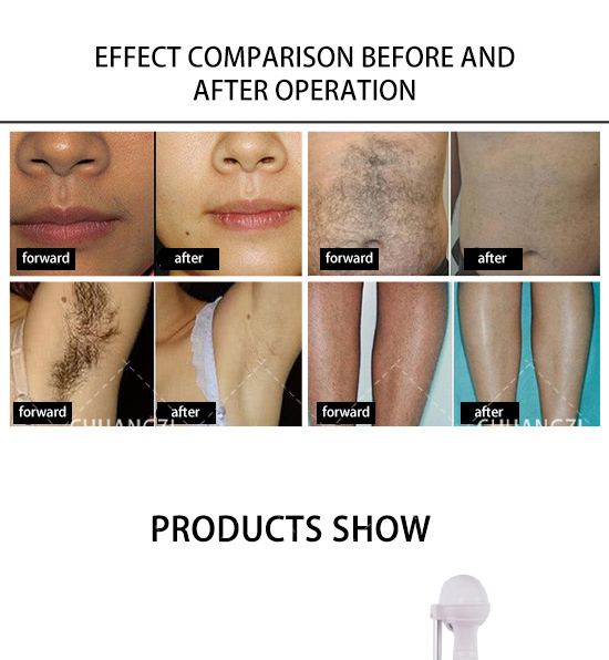 2023 Big Power 3 Wavelength 808 Diode Hair Removal Machine Professional Ce Approval 755nm 808nm 1064nm Hair Remove Salon