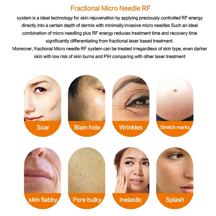 2 in 1 fractional  microneedling machine with cryo cold hammer stretch marks scar remover rf fractional micro needle machine