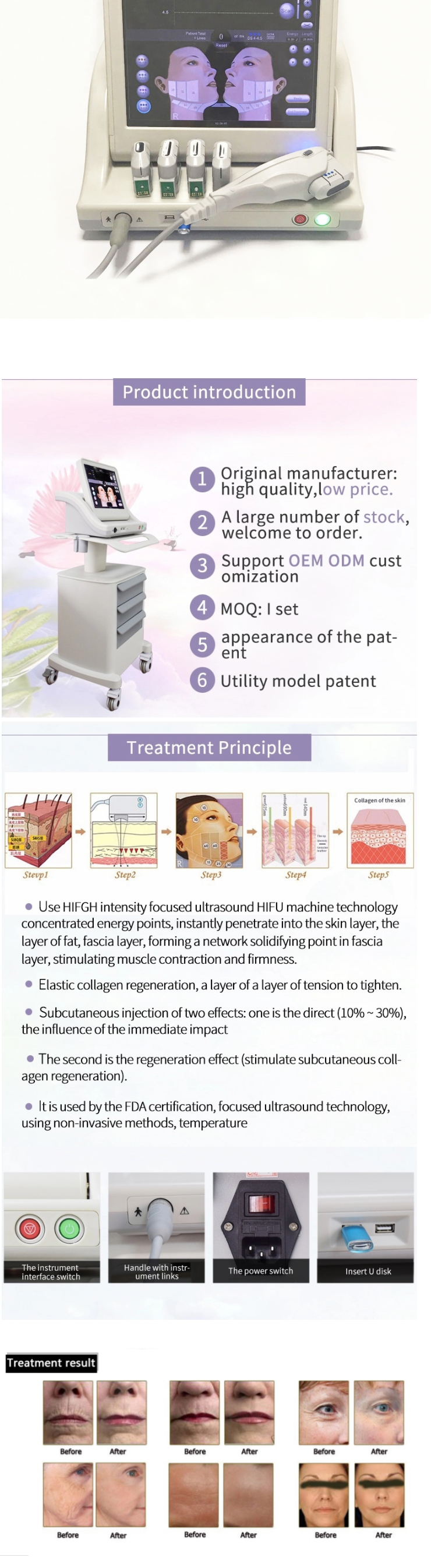 Beauty salon facial lift skin facial care machine (comes with 5 ink cartridges)