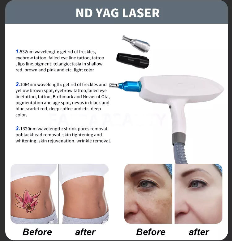 2023 Latest 2 In1Personal Care Appliances E-light+IPL OPT ND YAG Laser Multifunction Beauty Tattoo Hair Removal Machine