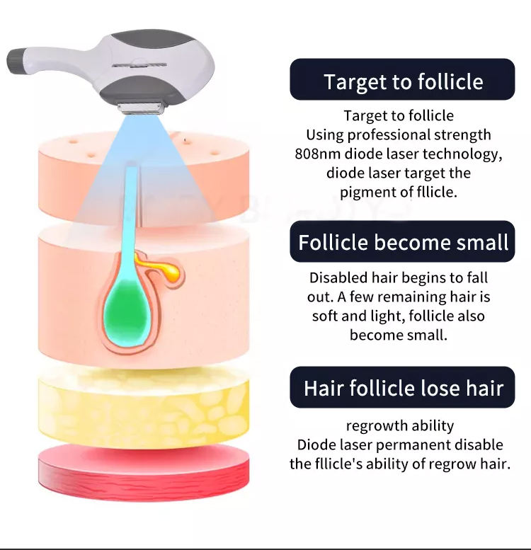 2023 Latest 2 In1Personal Care Appliances E-light+IPL OPT ND YAG Laser Multifunction Beauty Tattoo Hair Removal Machine