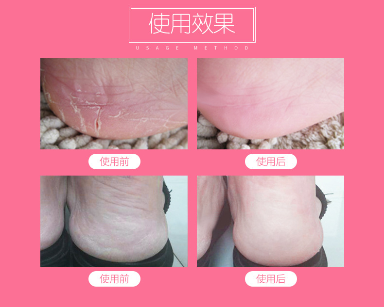 1 pair Reusable SPA Gel Socks Moisturizing Whitening Exfoliating Velvet Smooth Beauty Foot Care Silicone Socks Feet Care 1 pair Reusable SPA Gel Socks Moisturizing Whitening Exfoliating Velvet Smooth Beauty Foot Care Silicone Socks Feet Care