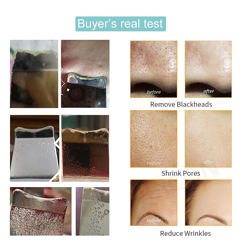Ultrasonic Skin Scrubber Peeling Blackhead Remover Deep Face Cleaning Ultrasonic Ion Ance Pore Cleaner Facial Shovel Cleanser Ultrasonic Skin Scrubber Peeling Blackhead Remover Deep Face Cleaning Ultrasonic Ion Ance Pore Cleaner Facial Shovel Cleanser