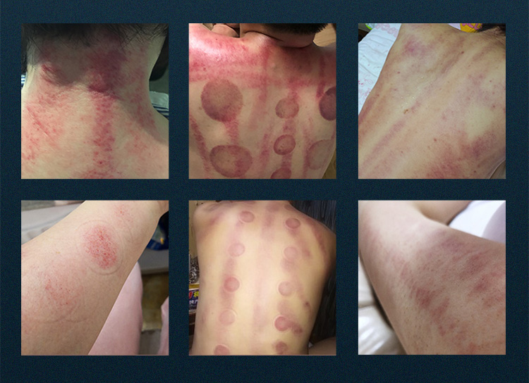 80K 9 in 1 Lipo Cavitation Ultrasonic Vacuum Slimming Radio Frequency Explosive RF+EMS Beauty Machine Face Skin Lifting Device