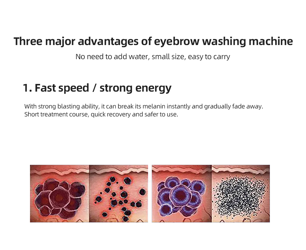 Portable Washing Machine Freckle Remove Tool