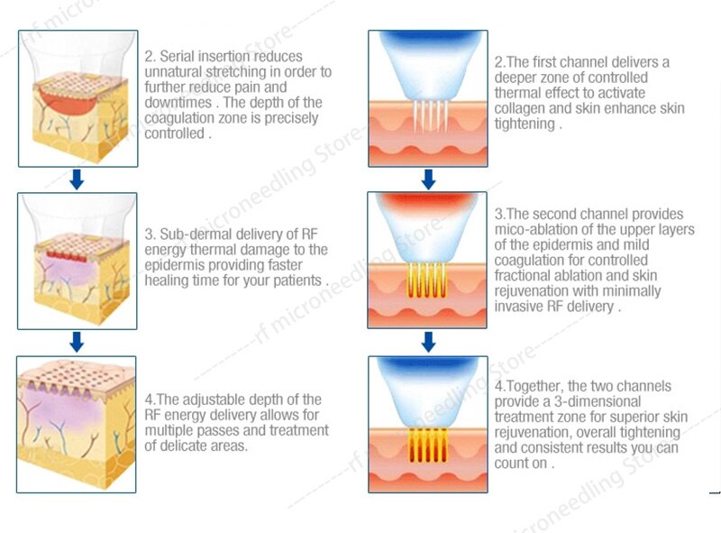 Latest Fractional Micro RF Micro Beauty Cold Hammer RF Machine Face Lift Anti-Acne Skin Morpheus 8