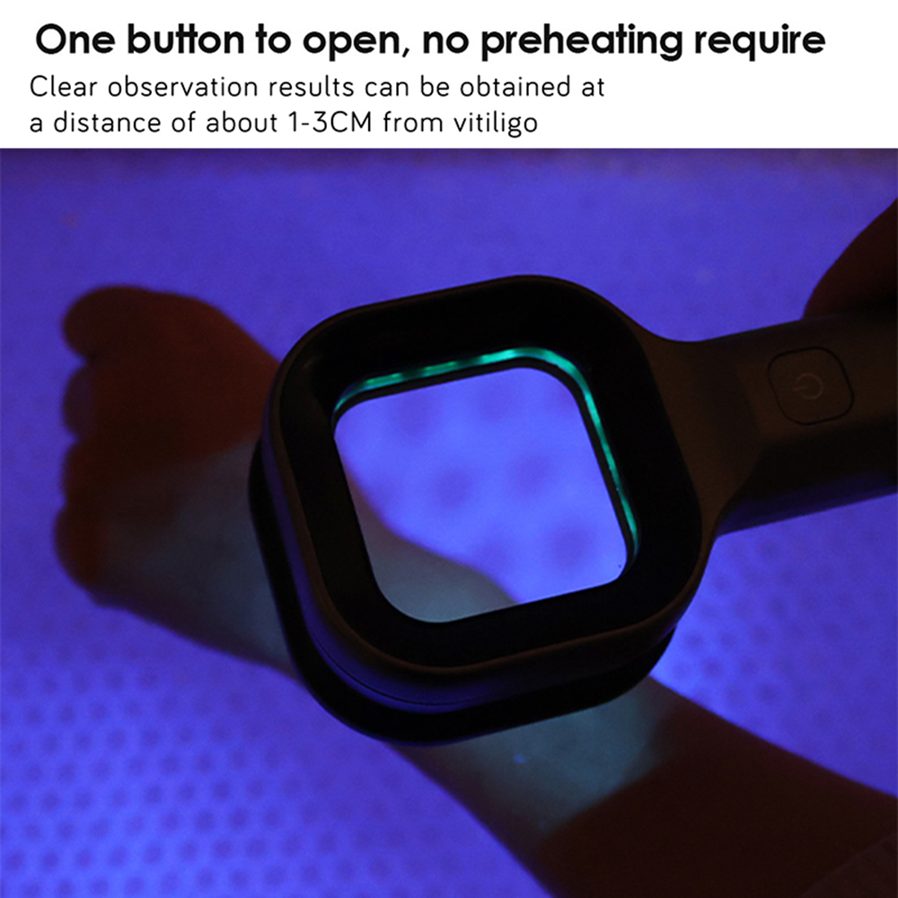 Woods Lamp For Skin Analyzer Machine Ultraviolet Lamp UV Skin Examination Beauty Test Facial Magnifying Analysis Vitiligo Lamp