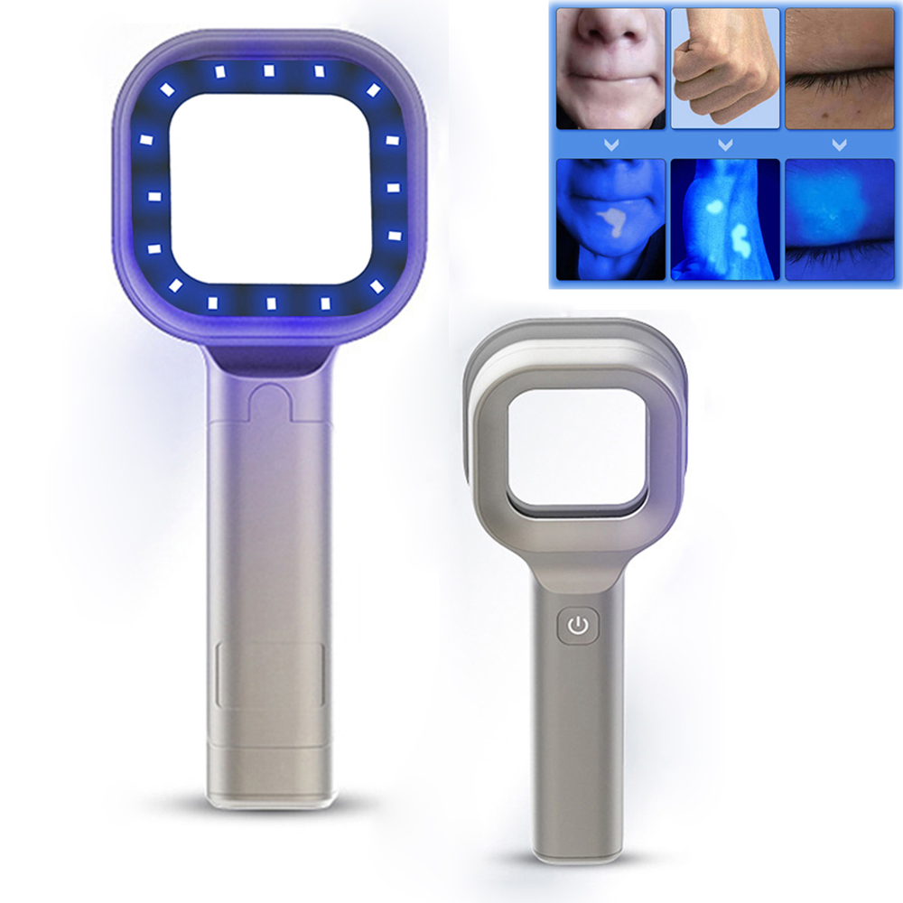 Woods Lamp For Skin Analyzer Machine Ultraviolet Lamp UV Skin Examination Beauty Test Facial Magnifying Analysis Vitiligo Lamp