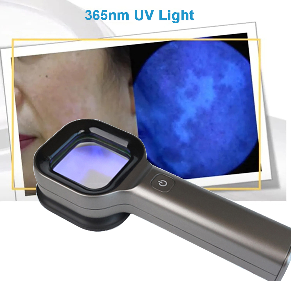 Woods Lamp For Skin Analyzer Machine Ultraviolet Lamp UV Skin Examination Beauty Test Facial Magnifying Analysis Vitiligo Lamp