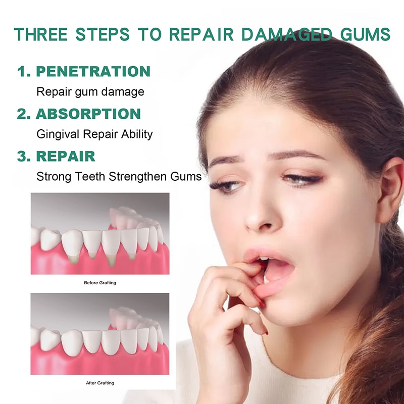 30ml Gum Regrowth Drops Relieve Mouth Periodontal Gum Bleeding Pain Treatment Bad Breat Antibacteria Oral Clean Care New 30ml Gum Regrowth Drops Relieve Mouth Periodontal Gum Bleeding Pain Treatment Bad Breat Antibacteria Oral Clean Care New