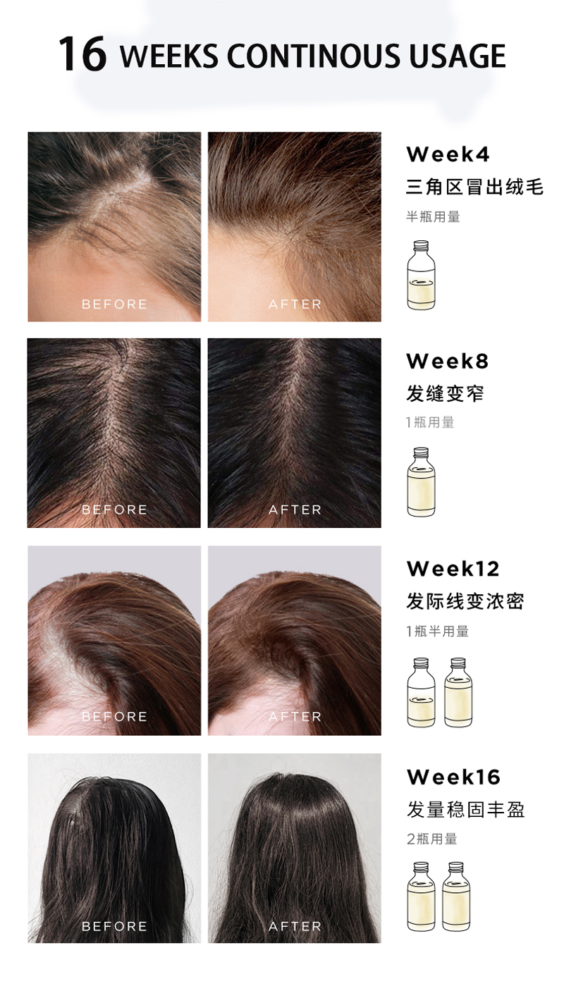 Thrive Hair Growth Essential Oil Hair Daily Care Repair Damage Baldness Scalp Treatment Hair Loss Fast Growing Germinal Serum