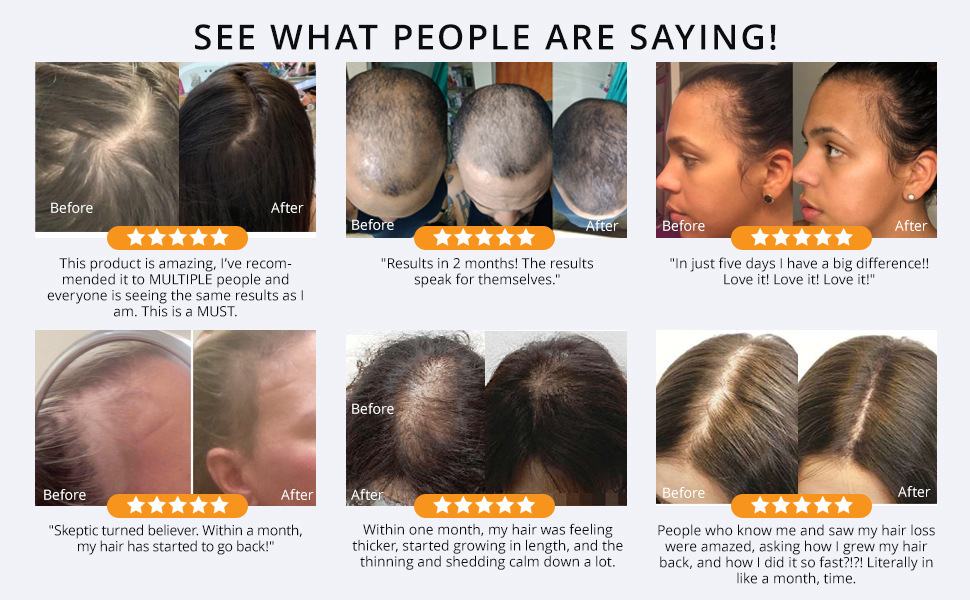 Thrive Hair Growth Essential Oil Hair Daily Care Repair Damage Baldness Scalp Treatment Hair Loss Fast Growing Germinal Serum